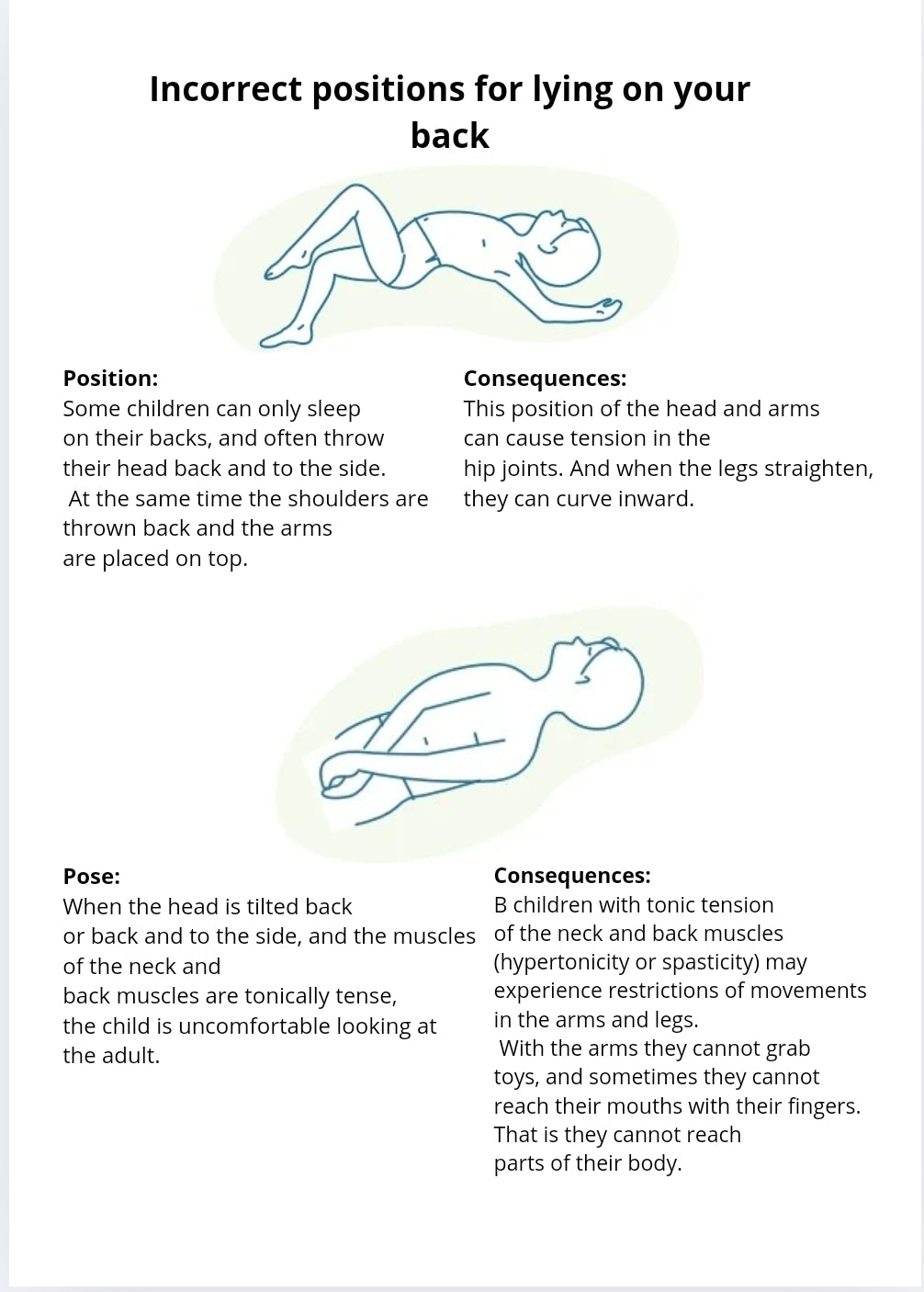 Positioning of a child with motor disorders and selection equipment.